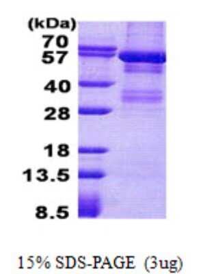 SDS-PAGE: Recombinant Human Lyn His Protein [NBP2-22945]