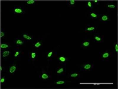 Immunocytochemistry/ Immunofluorescence: Lyp/PTPN22 Antibody (1A6) [H00026191-M02]