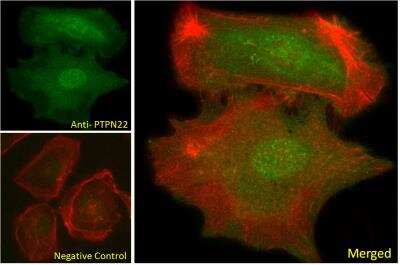 Immunocytochemistry/ Immunofluorescence: Lyp/PTPN22 Antibody [NBP2-69989]