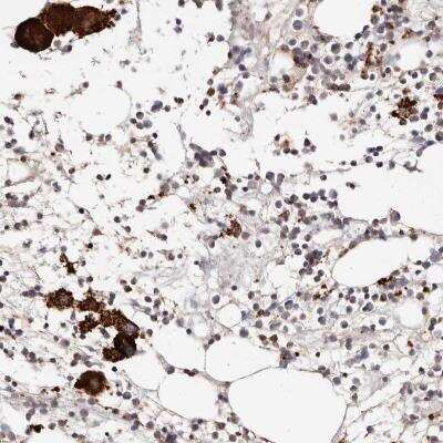 Immunohistochemistry-Paraffin: Lyp/PTPN22 Antibody [NBP1-81276]