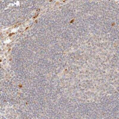 Immunohistochemistry-Paraffin: Lyp/PTPN22 Antibody [NBP1-81277]