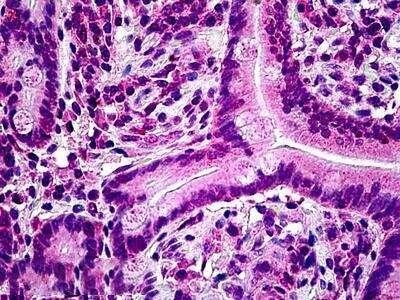 Immunohistochemistry-Paraffin: Lyp/PTPN22 Antibody [NBP2-69989]