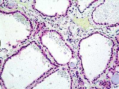 Immunohistochemistry-Paraffin: Lyp/PTPN22 Antibody [NBP2-69989]