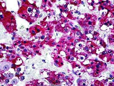 Immunohistochemistry-Paraffin: Lyp/PTPN22 Antibody [NBP2-69989]