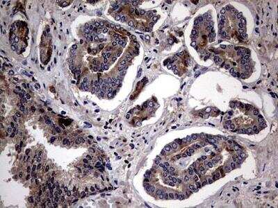 Immunohistochemistry-Paraffin: Lysine Hydroxylase 2/PLOD2 Antibody (OTI6D1) [NBP2-46451]