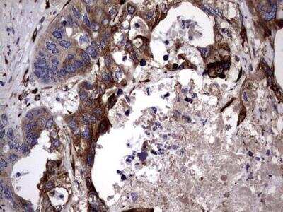 Immunohistochemistry-Paraffin: Lysine Hydroxylase 2/PLOD2 Antibody (OTI6D1) [NBP2-46451]