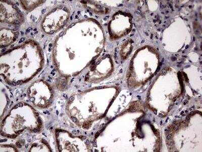 Immunohistochemistry-Paraffin: Lysine Hydroxylase 2/PLOD2 Antibody (OTI6D1) [NBP2-46451]