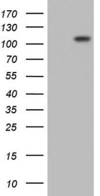 Western Blot: Lysine Hydroxylase 2/PLOD2 Antibody (OTI6D1)Azide and BSA Free [NBP2-72556]