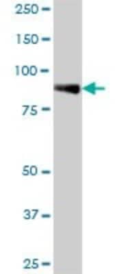 Western Blot: Lysine Hydroxylase 2/PLOD2 Antibody [H00005352-B01P]