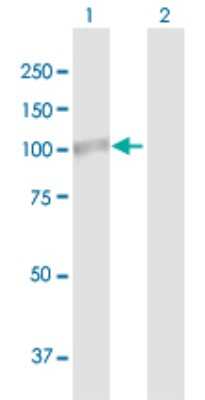 Western Blot: Lysine Hydroxylase 2/PLOD2 Antibody [H00005352-B01P]