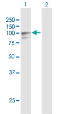 Western Blot: Lysine Hydroxylase 2/PLOD2 Antibody [H00005352-D01P]