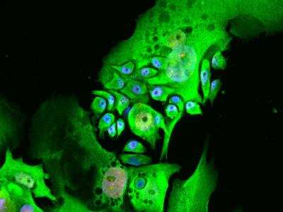 Immunocytochemistry/ Immunofluorescence: Lysine (K)-specific Demethylase 3A/KDM3A/JMJD1A Antibody [NB100-77282]