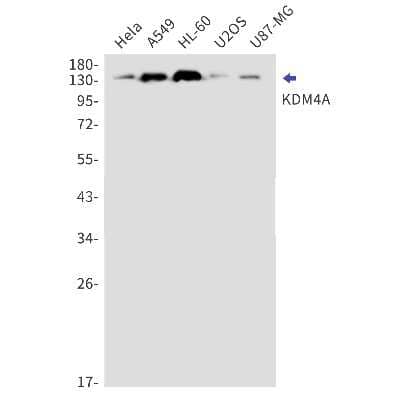 Western Blot: Lysine (K)-specific Demethylase 4A/KDM4A/JMJD2A Antibody (S01-7F2) [NBP3-15055]