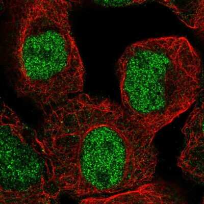 Immunocytochemistry/ Immunofluorescence: Lysine (K)-specific Demethylase 4C/KDM4C/JMJD2C Antibody [NBP2-57484]