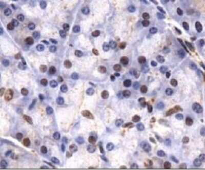 Immunohistochemistry-Paraffin: Lysine (K)-specific Demethylase 4C/KDM4C/JMJD2C Antibody - BSA Free [NBP1-49600]