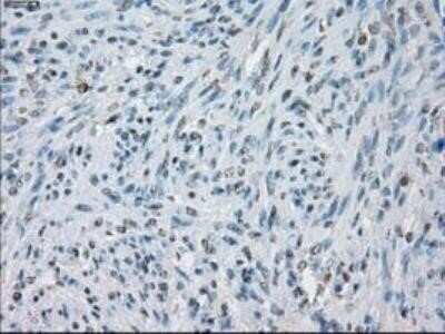Immunohistochemistry: Lysine (K)-specific Demethylase 4C/KDM4C/JMJD2C Antibody (OTI5B9) - Azide and BSA Free [NBP2-72553]