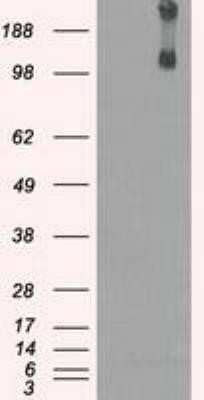 Western Blot: Lysine (K)-specific Demethylase 4C/KDM4C/JMJD2C Antibody (OTI5B9)Azide and BSA Free [NBP2-72553]