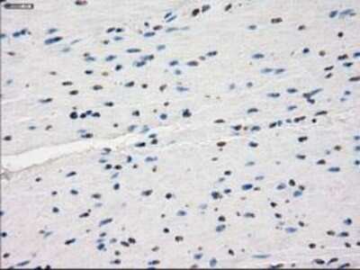 Immunohistochemistry-Paraffin: Lysine (K)-specific Demethylase 4C/KDM4C/JMJD2C Antibody (OTI5B9) [NBP1-47815]