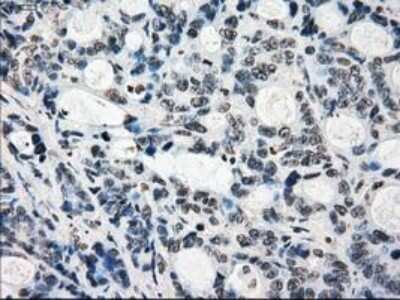Immunohistochemistry-Paraffin: Lysine (K)-specific Demethylase 4C/KDM4C/JMJD2C Antibody (OTI5B9) [NBP1-47815]