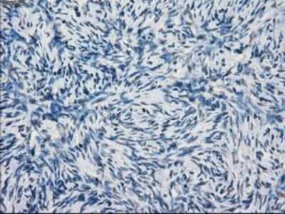 Immunohistochemistry-Paraffin: Lysine (K)-specific Demethylase 4C/KDM4C/JMJD2C Antibody (OTI5B9) [NBP1-47815]