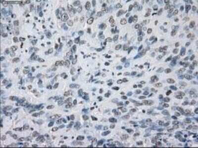 Immunohistochemistry-Paraffin: Lysine (K)-specific Demethylase 4C/KDM4C/JMJD2C Antibody (OTI5B9) [NBP1-47815]