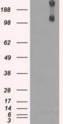 Western Blot: Lysine (K)-specific Demethylase 4C/KDM4C/JMJD2C Antibody (OTI5B9) [NBP1-47815]