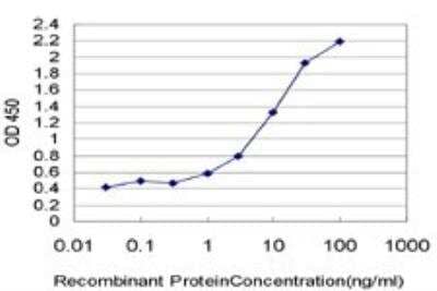 ELISA: Lysine (K)-specific Demethylase 5B/KDM5B/JARID1B Antibody (1G10) [H00010765-M02]