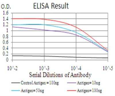 ELISA: Lysine (K)-specific Demethylase 5B/KDM5B/JARID1B Antibody (7H3D7) - BSA Free [NBP2-52500]