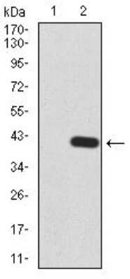 Western Blot: Lysine (K)-specific Demethylase 5B/KDM5B/JARID1B Antibody (7H3D7)BSA Free [NBP2-52500]
