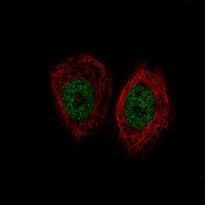 Immunocytochemistry/ Immunofluorescence: Lysine (K)-specific Demethylase 5B/KDM5B/JARID1B Antibody (CL1129) [NBP2-52969]