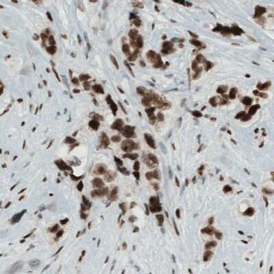 Immunohistochemistry-Paraffin: Lysine (K)-specific Demethylase 5B/KDM5B/JARID1B Antibody (CL1129) [NBP2-52969]