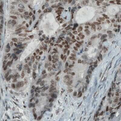 Immunohistochemistry-Paraffin: Lysine (K)-specific Demethylase 5B/KDM5B/JARID1B Antibody (CL1129) [NBP2-52969]