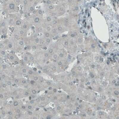 Immunohistochemistry-Paraffin: Lysine (K)-specific Demethylase 5B/KDM5B/JARID1B Antibody (CL1129) [NBP2-52969]