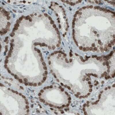 Immunohistochemistry-Paraffin: Lysine (K)-specific Demethylase 5B/KDM5B/JARID1B Antibody (CL1129) [NBP2-52969]