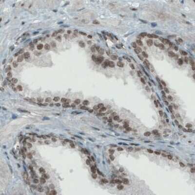 Immunohistochemistry-Paraffin: Lysine (K)-specific Demethylase 5B/KDM5B/JARID1B Antibody (CL1129) [NBP2-52969]