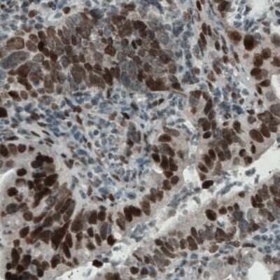 Immunohistochemistry-Paraffin: Lysine (K)-specific Demethylase 5B/KDM5B/JARID1B Antibody (CL1129) [NBP2-52969]
