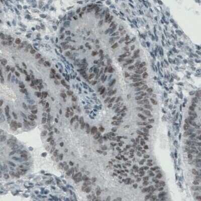 Immunohistochemistry-Paraffin: Lysine (K)-specific Demethylase 5B/KDM5B/JARID1B Antibody (CL1129) [NBP2-52969]