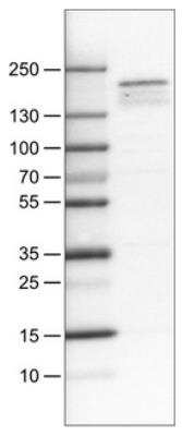 Western Blot: Lysine (K)-specific Demethylase 5B/KDM5B/JARID1B Antibody (CL1147) [NBP2-34473]