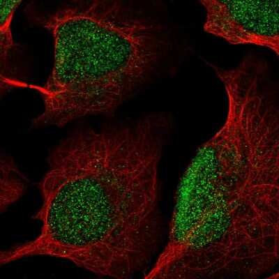 Immunocytochemistry/ Immunofluorescence: Lysine (K)-specific Demethylase 5B/KDM5B/JARID1B Antibody [NBP2-58615]