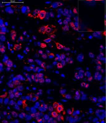 Immunohistochemistry-Paraffin: Lysine (K)-specific Demethylase 5B/KDM5B/JARID1B Antibody [NB100-97821]