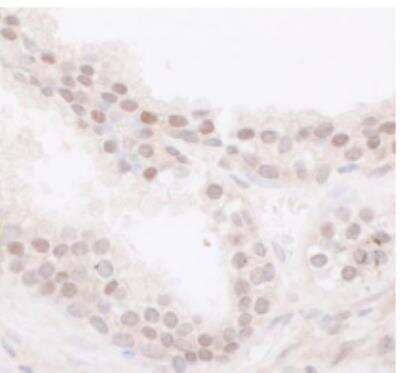 Immunohistochemistry-Paraffin: Lysine (K)-specific Demethylase 5B/KDM5B/JARID1B Antibody [NB100-97821]