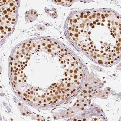 Immunohistochemistry-Paraffin: Lysine (K)-specific Demethylase 5B/KDM5B/JARID1B Antibody [NBP1-84352]