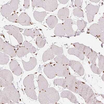 Immunohistochemistry-Paraffin: Lysine (K)-specific Demethylase 5B/KDM5B/JARID1B Antibody [NBP1-84352]