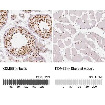 Immunohistochemistry-Paraffin: Lysine (K)-specific Demethylase 5B/KDM5B/JARID1B Antibody [NBP1-84352]