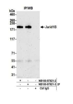 Immunoprecipitation: Lysine (K)-specific Demethylase 5B/KDM5B/JARID1B Antibody [NB100-97821]