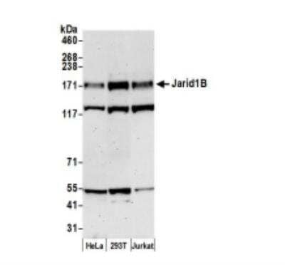 Western Blot: Lysine (K)-specific Demethylase 5B/KDM5B/JARID1B Antibody [NB100-97821]