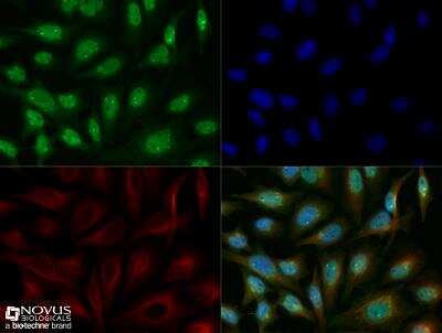 Immunocytochemistry/ Immunofluorescence: Lysine (K)-specific Demethylase 6B/KDM6B/JMJD3 Antibody - BSA Free [NBP1-06640]