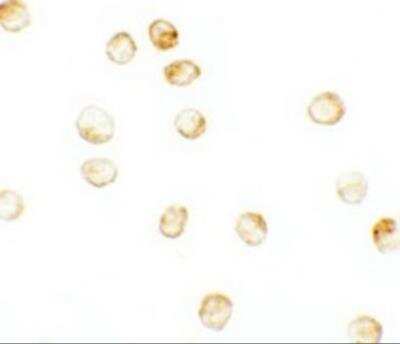 Immunocytochemistry/ Immunofluorescence: Lysine (K)-specific Demethylase 6B/KDM6B/JMJD3 Antibody - BSA Free [NBP2-82107]