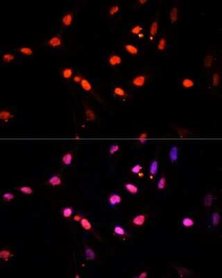Immunocytochemistry/ Immunofluorescence: Lysine (K)-specific Demethylase 6B/KDM6B/JMJD3 Antibody - Azide and BSA Free [NBP2-92982]