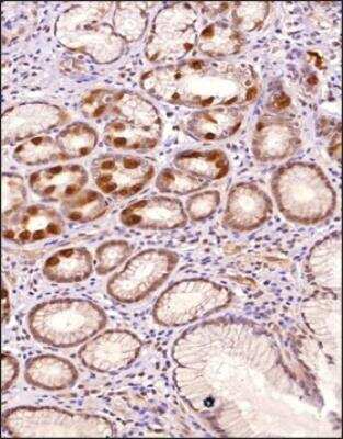 Immunohistochemistry-Paraffin: Lysine (K)-specific Demethylase 6B/KDM6B/JMJD3 Antibody - BSA Free [NBP3-06855]